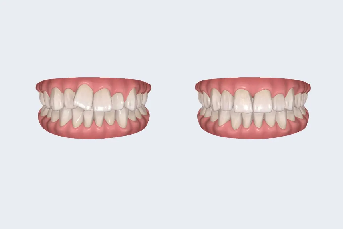 治療完了までを事前にシミュレーション